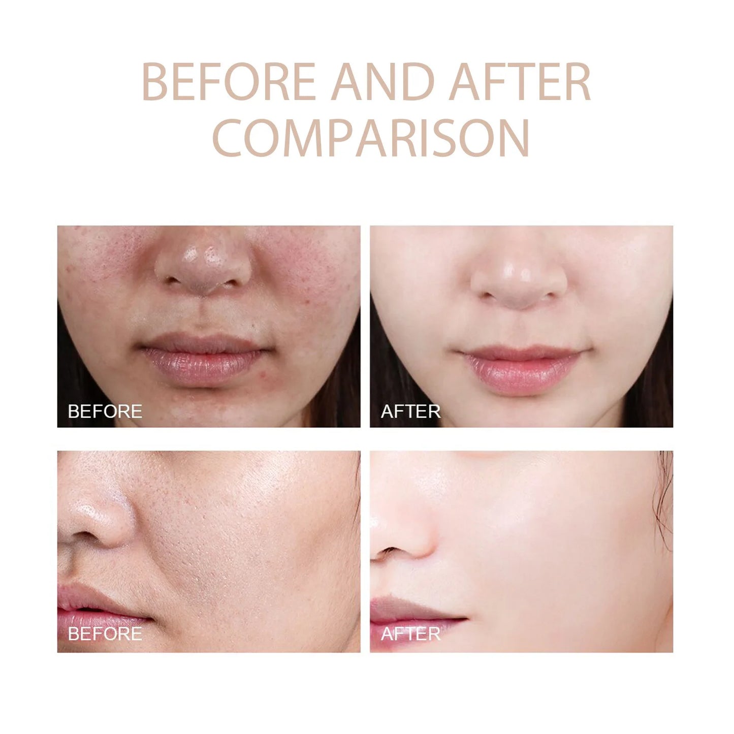 Ouhoe Deep Cleaning Exfoliating Facial Gel