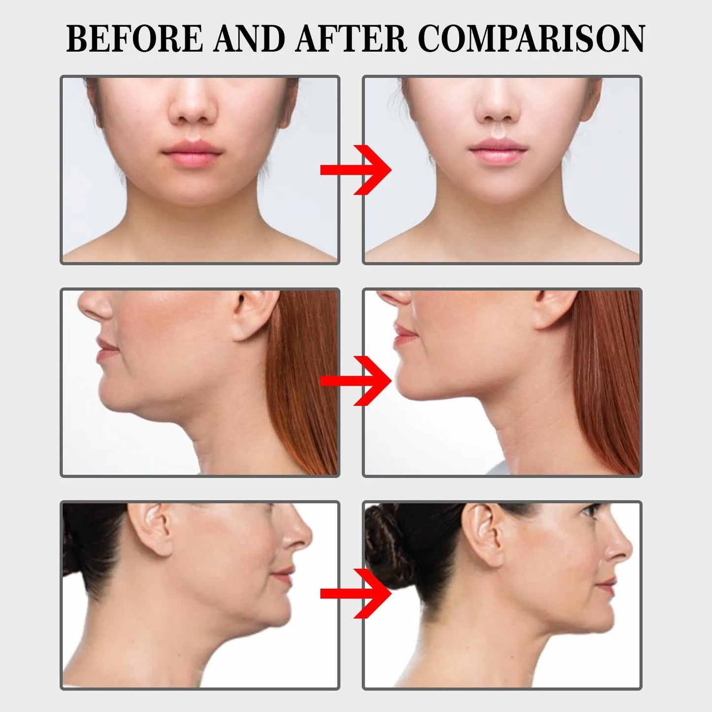 Jaysuing Invisible Face Lifting Patch For Chin Contouring