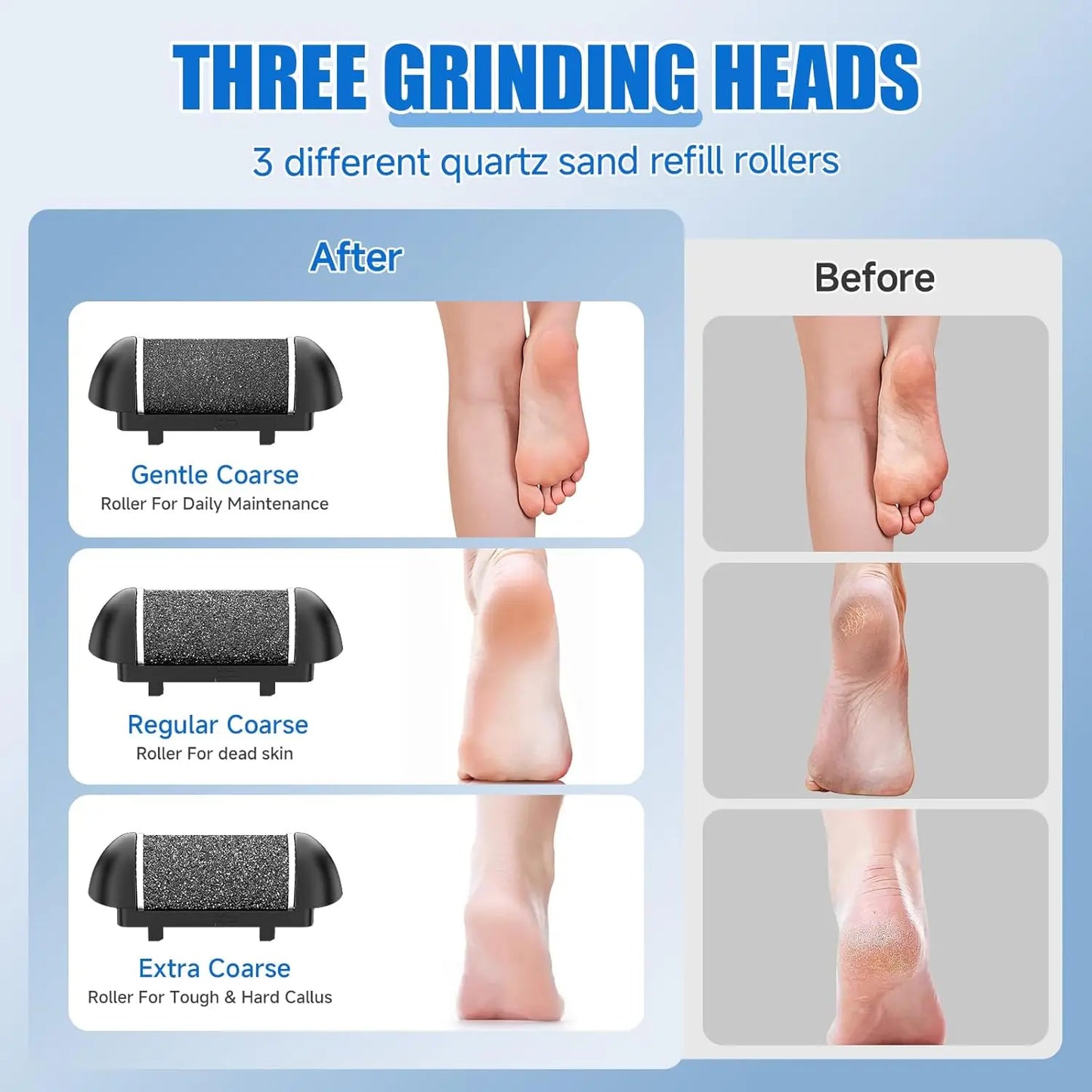 Electric Callus Remover 17 In 1 Pedicure Kit USB Rechargeable