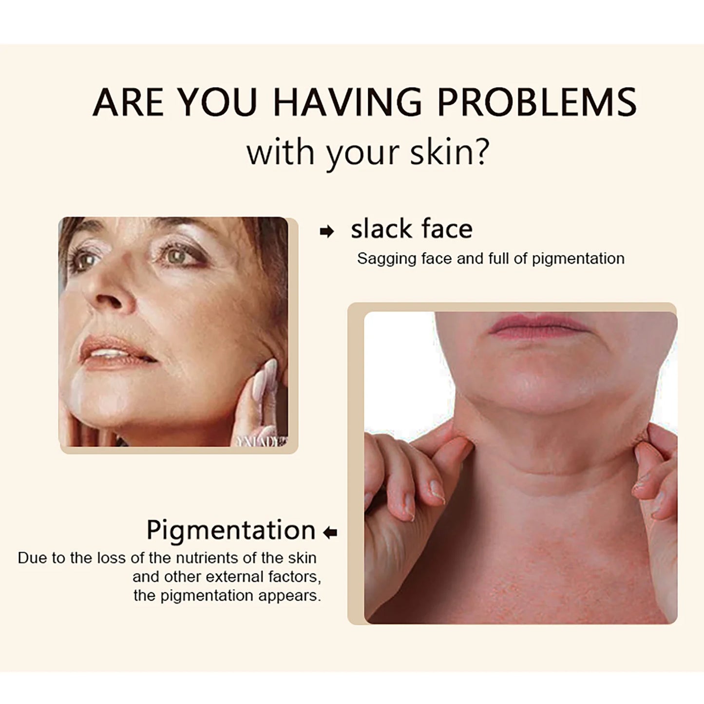 Kyliefit Collagen Whitening Cream For Brightening And Hydration